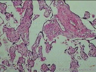 胎盘组织图9