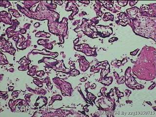 胎盘组织图37