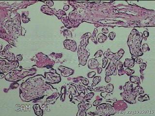 胎盘组织图1