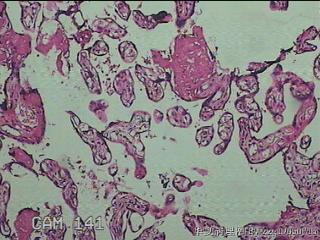 胎盘组织图24