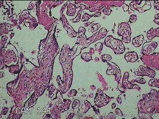 胎盘组织图28