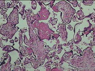 胎盘组织图18