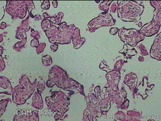 胎盘组织图7