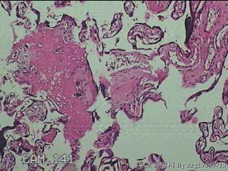 胎盘组织图26
