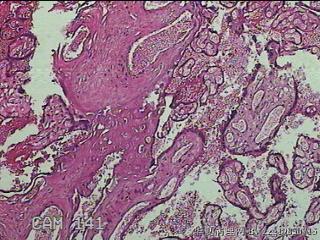 胎盘组织图31