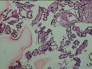 胎盘组织图34