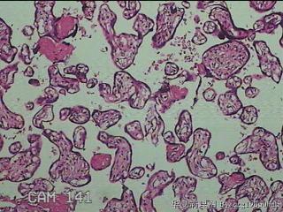 胎盘组织图23
