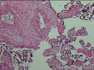 胎盘组织图8