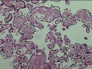 胎盘组织图14
