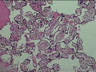 胎盘组织图2