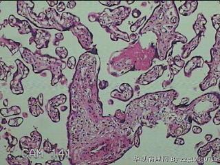 胎盘组织图11