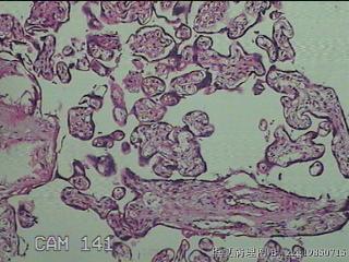 胎盘组织图5