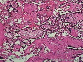 胎盘组织图41