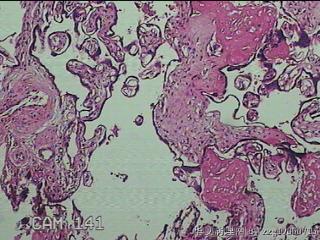胎盘组织图19