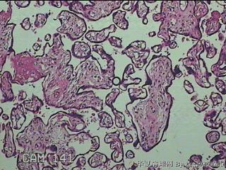 胎盘组织图16