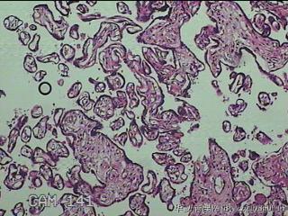 胎盘组织图15