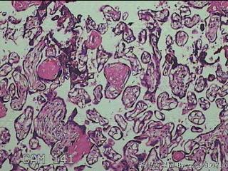 胎盘组织图13