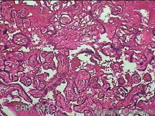 胎盘组织图36