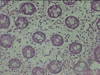 直肠粘膜图23