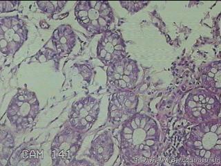 直肠粘膜图29