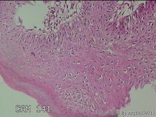 后联合赘生物图38