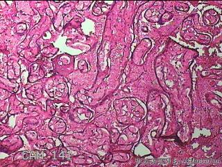胎盘图28