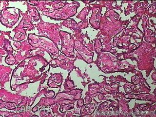 胎盘图33