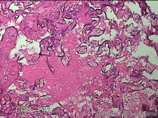 胎盘图16