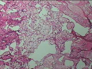 胎盘图37