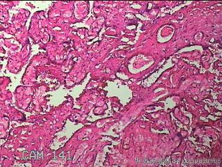胎盘图44