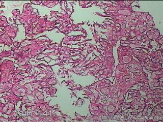 胎盘图38