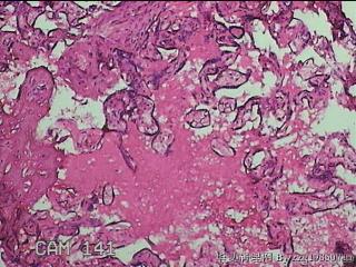 胎盘图6