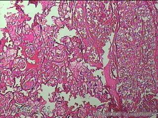 胎盘图48