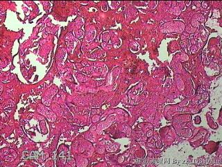 胎盘图45