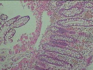 直肠粘膜图2