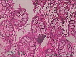 直肠粘膜图41