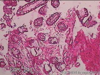 直肠粘膜图12