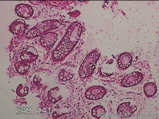 直肠粘膜图13