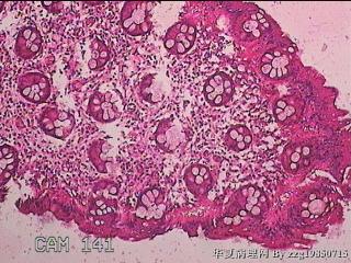 直肠粘膜图1