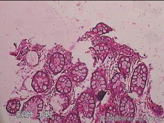 直肠粘膜图11