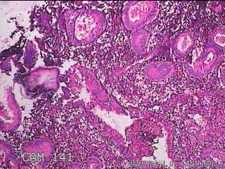 子宫内膜图27