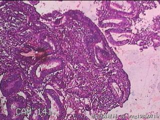 子宫内膜图38