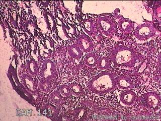 子宫内膜图9