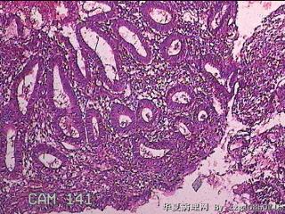 子宫内膜图35
