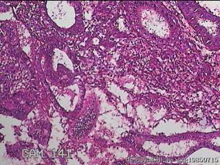 子宫内膜图45