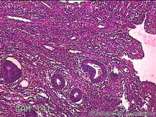 子宫内膜组织图24