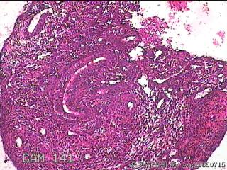子宫内膜组织图17