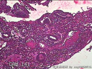 子宫内膜组织图22