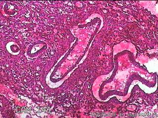 子宫内膜组织图47