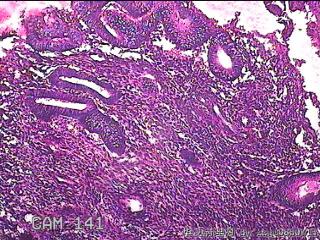 子宫内膜组织图35